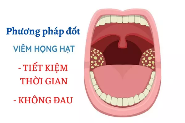 phuong-phap-dot-viem-hong-hat-tiet-kiem-thoi-gian-va-khong-gay-dau.webp